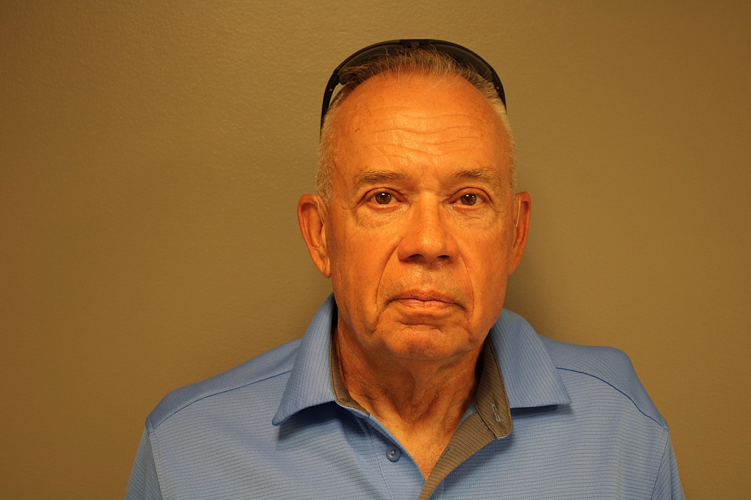 Blepharoplasty Before & After